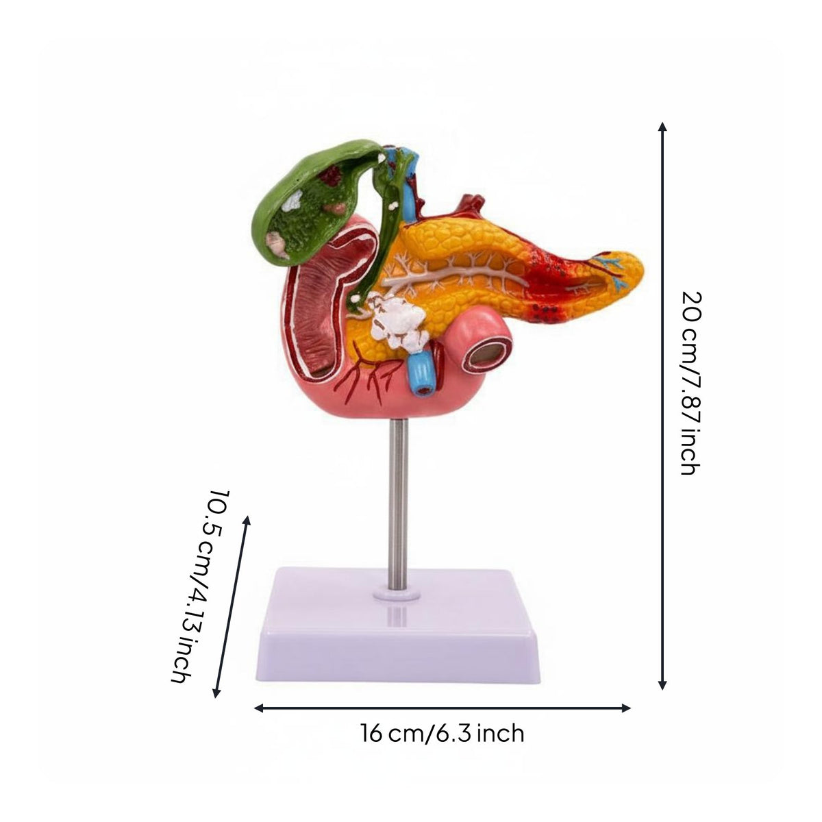 Digestive System Pathology Model Display Pancreas Duodenum Gallbladder Model PVC Material Teaching Aid for Physician's Office