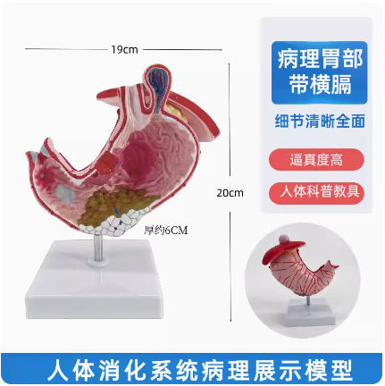 Large Stomach Model