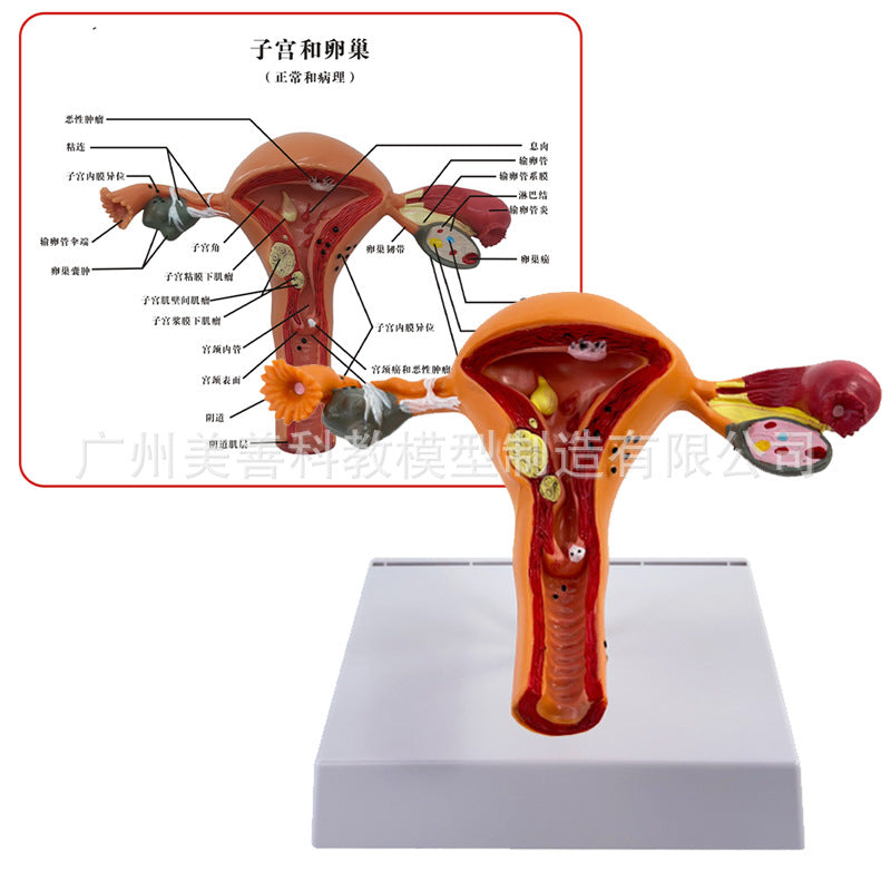 Pathological Uterus