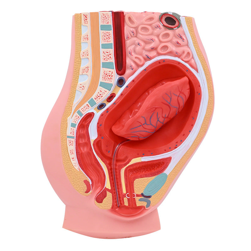 Placental Abruption
