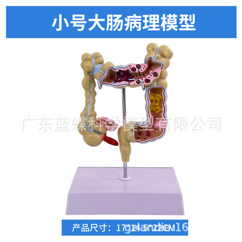 Small / Large Intestine