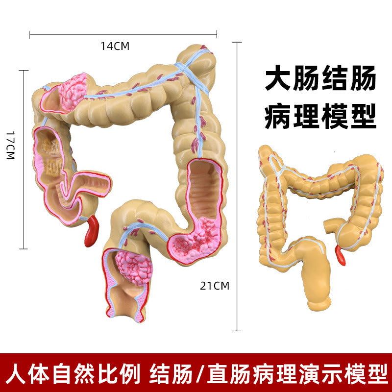 Large Intestine