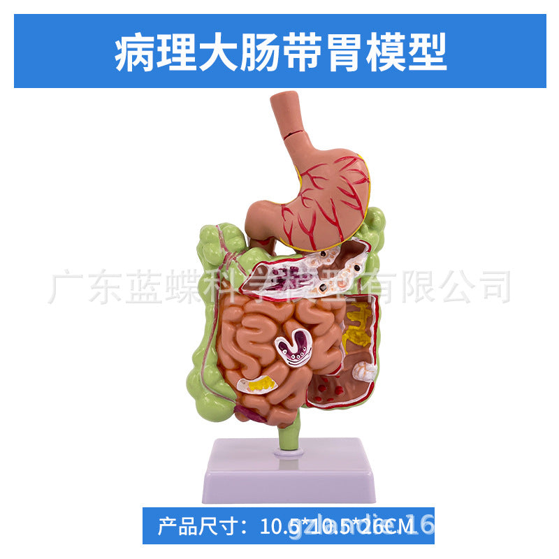 1-2 Size / Intestine W Stomach
