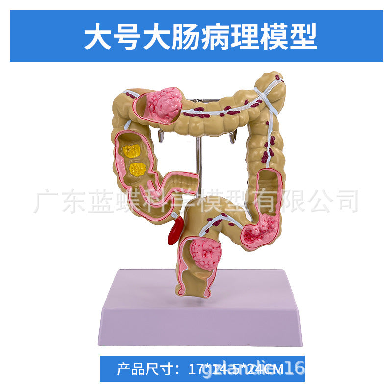 Large / Large Intestine