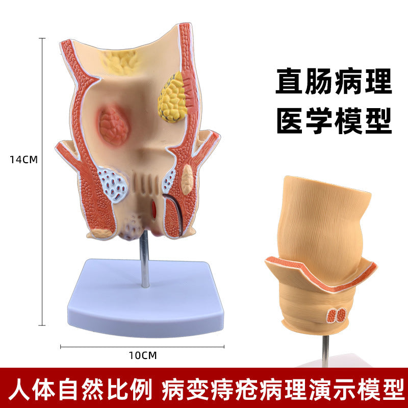 Rectal Model