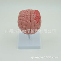 Human Brain Anatomy Model for Stroke and Brain Disease Education