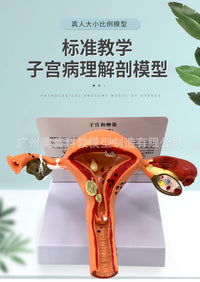 人体女性生殖子宫解剖病理模型 阴道卵巢教学模型 妇科生殖科教具