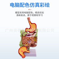 教学仿真人体胃解剖模型胃放大胃部疾病演示病理胃带横隔胃的穿孔