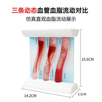 仿真动态血管模型血脂浓稠度流动堵塞对比斑块血栓病理加大教具