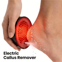 Electric Callus Remover Foot File with Red and Blue Light