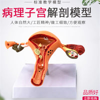 人体女性生殖子宫解剖病理模型 阴道卵巢教学模型 妇科生殖科教具