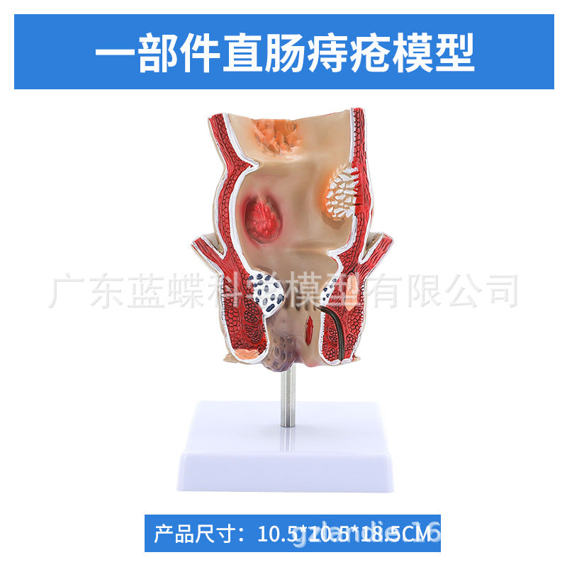 1 Part / Rectal Hemorrhoid