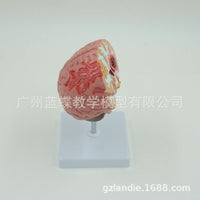 Human Brain Anatomy Model for Stroke and Brain Disease Education