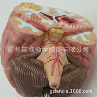 Human Brain Anatomy Model for Stroke and Brain Disease Education