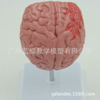 Human Brain Anatomy Model for Stroke and Brain Disease Education