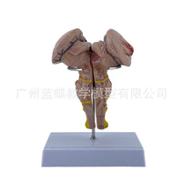 Magnified Brainstem Model with Midbrain, Pons, Medulla, Diencephalon and Cranial Nerves