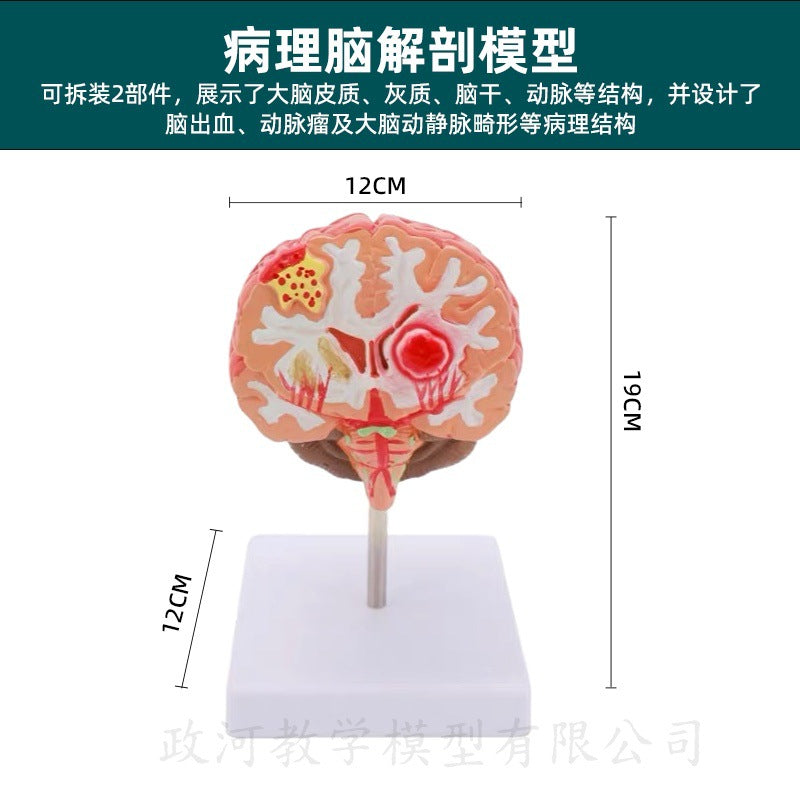 Pathological Model