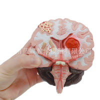 Human Brain Anatomy Model for Stroke and Brain Disease Education
