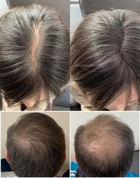 Hair Fiber Applicator Powder Sprayer Head for Thinning Hair and Hairline