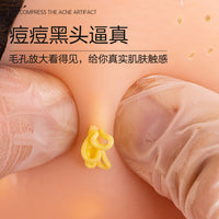 解压挤痘痘拔粉刺仿真大头模型礼盒精装痘硅胶人偶创意潮玩礼物