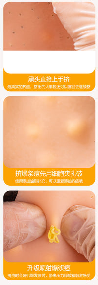 解压挤痘痘拔粉刺仿真大头模型礼盒精装痘硅胶人偶创意潮玩礼物