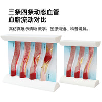 仿真动态血管模型血脂浓稠度流动堵塞对比斑块血栓病理加大教具