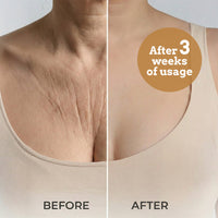 Chest Support Pillow for Beauty and Prevention of Sagging