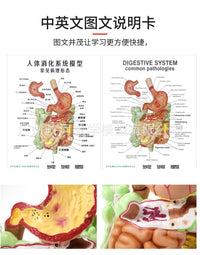 人体消化系统模型 胃解剖 大肠 盲肠 直肠 十二指肠 人体内脏构造