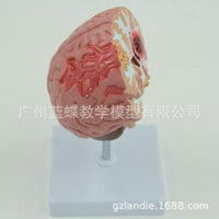 Human Brain Anatomy Model for Stroke and Brain Disease Education