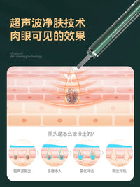 Ultrasonic Skin Scrubber Blackhead Remover Pore Cleaner Facial Spatula