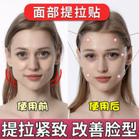 Invisible V-Face Lifting Patches for Instant Face Lift and Tightening