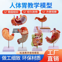 教学仿真人体胃解剖模型胃放大胃部疾病演示病理胃带横隔胃的穿孔