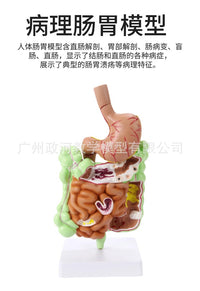 人体消化系统模型 胃解剖 大肠 盲肠 直肠 十二指肠 人体内脏构造