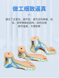 正常足 扁平足 弓型足 模型 足部病理模型人体足部肌肉解剖模型