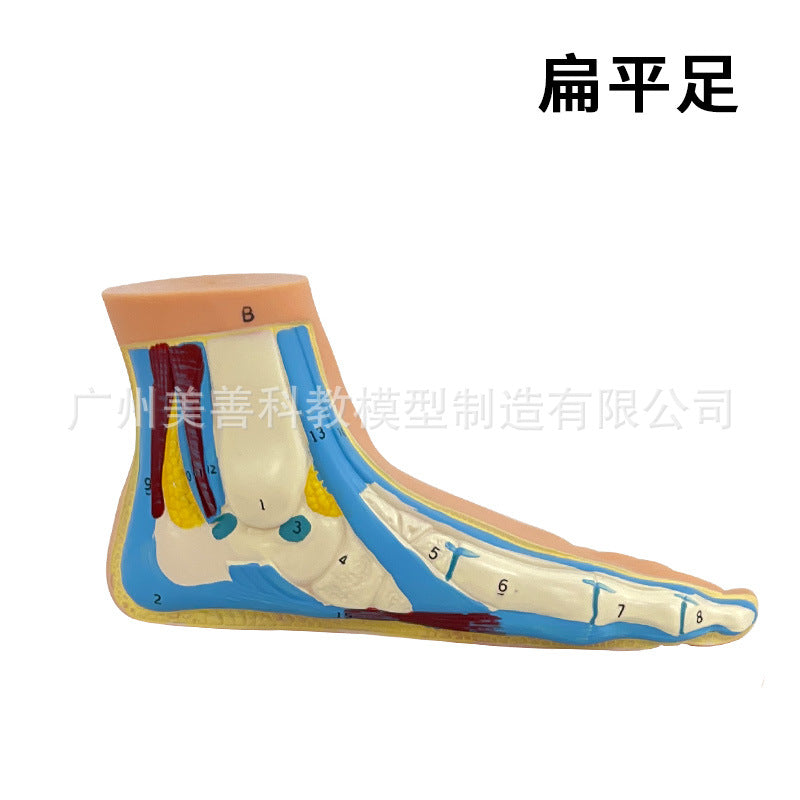 Flat Foot-engraved
