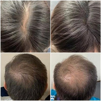 Hair Fiber Applicator Powder Sprayer Head for Thinning Hair and Hairline