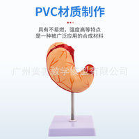 教学仿真人体胃解剖模型胃放大胃部疾病演示病理胃带横隔胃的穿孔
