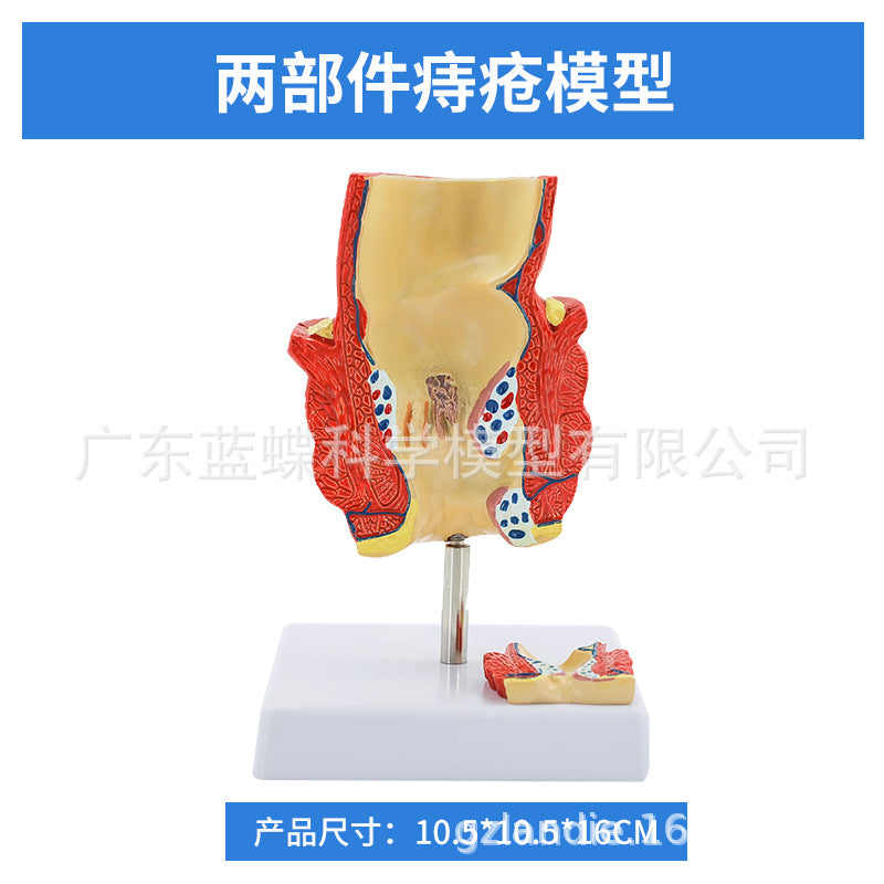 2 Parts / Rectal Hemorrhoid