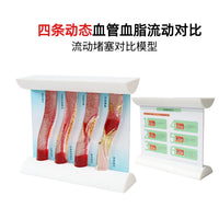 仿真动态血管模型血脂浓稠度流动堵塞对比斑块血栓病理加大教具