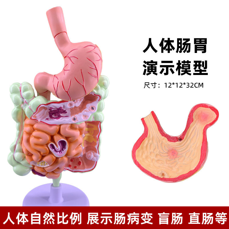 Gastro Model