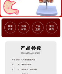 人体大肠病理模型 肠胃解剖模型 病态大肠盲肠 直肠 十二指肠模型